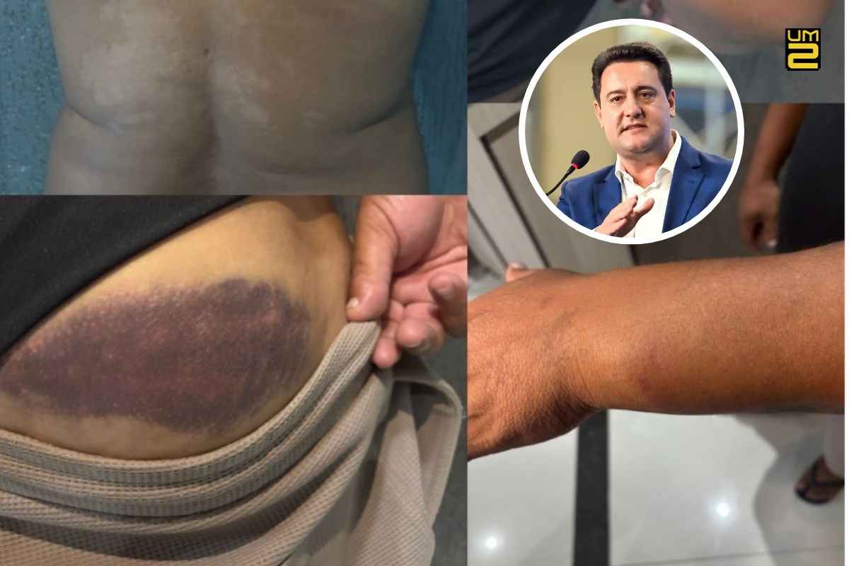 Campeão mundial é agredido pela Polícia Militar no Paraná e Ratinho Jr. reage